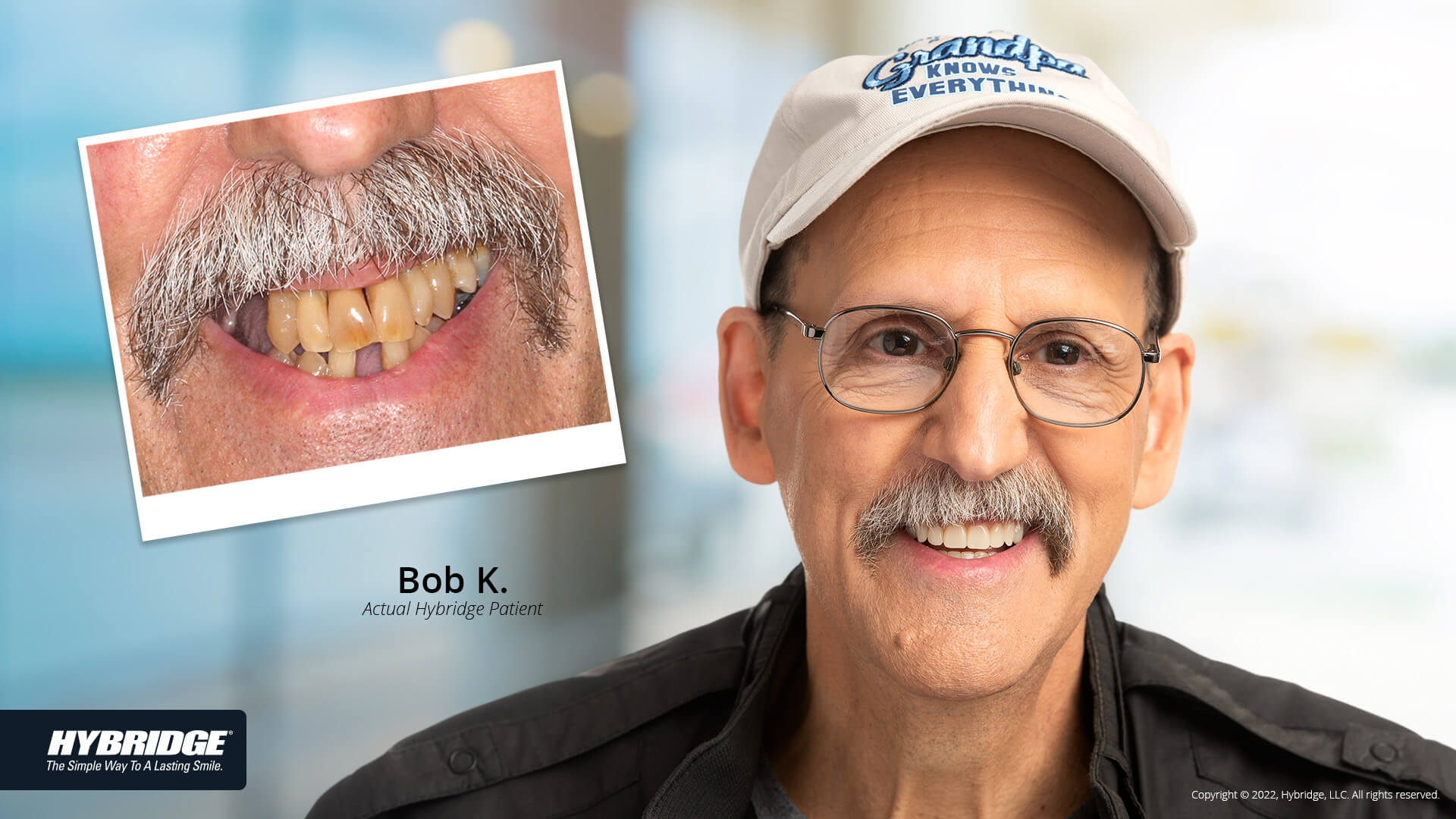 before-after_smile_gallery_w-bkgds_bob_1920x1080